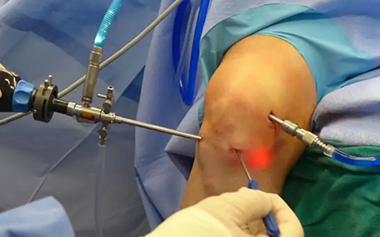 cirugia-cadera-rodilla