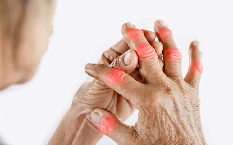 inflamacion-articulaciones